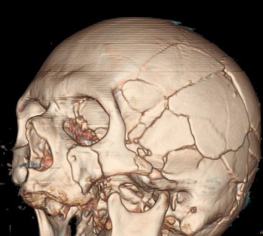 Компьютерная томография КТ головного мозга в Киеве