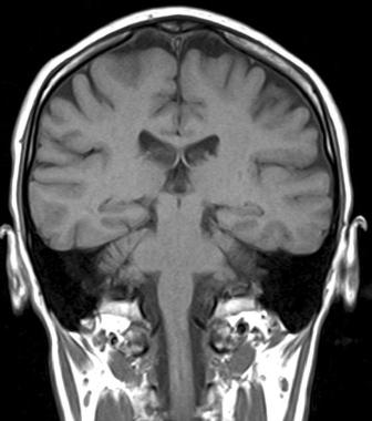 томография мозга Киев